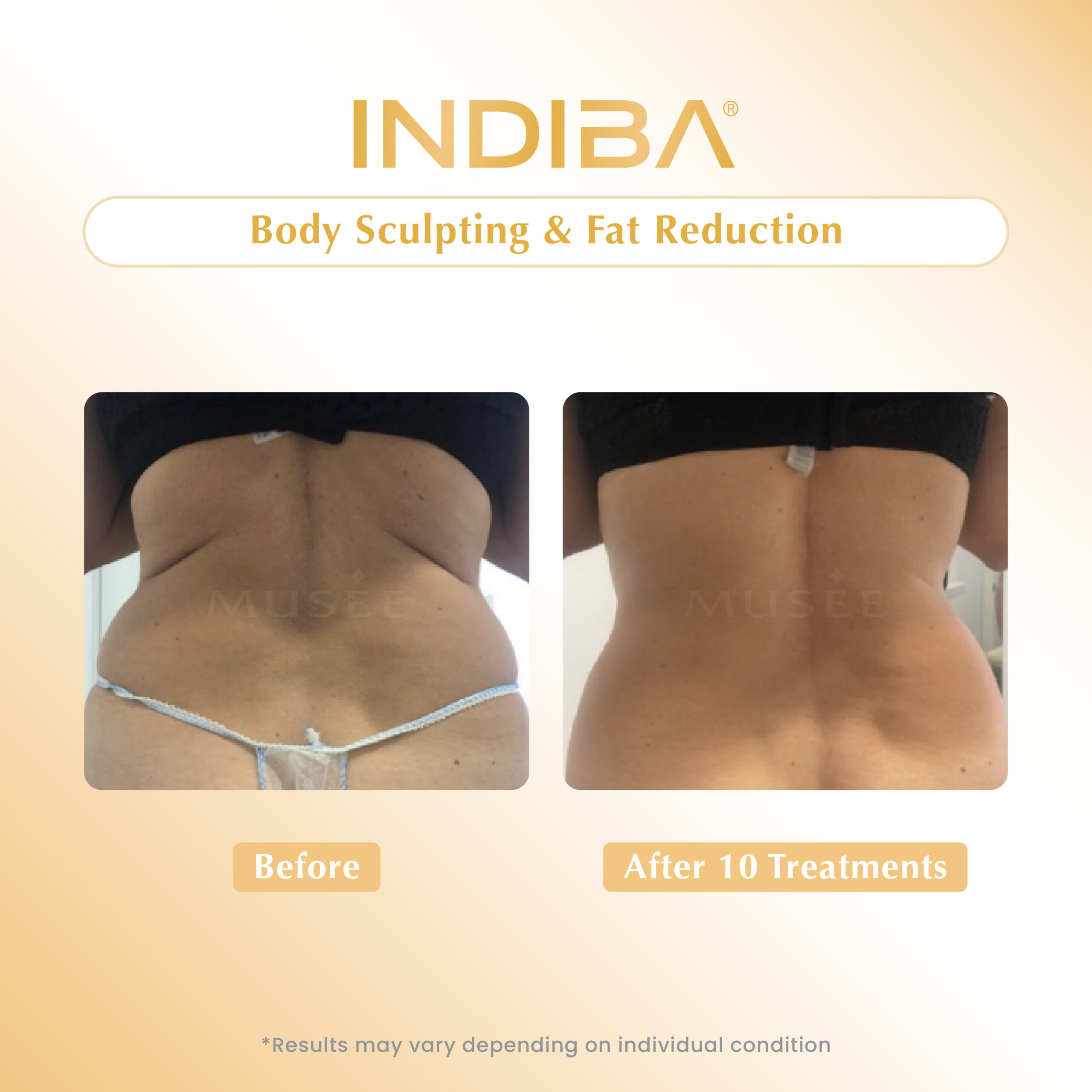 Body Sculpting & Fat Reduction_01